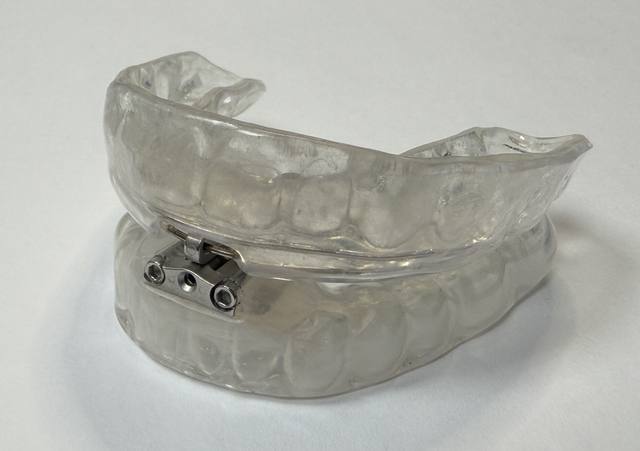 TAP oral appliance for sleep apnea with front adjustment hardware, fitted at Argyle Dental Sleep and TMJ